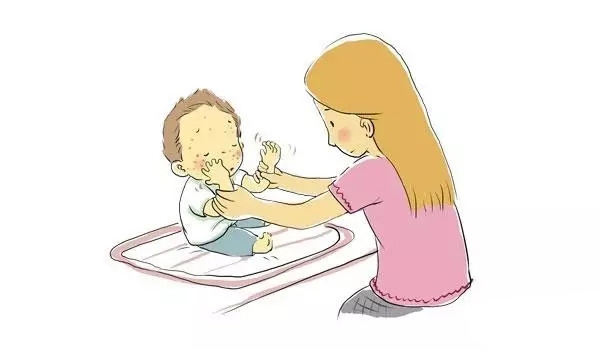 婴儿起奶癣怎么办母乳分析仪厂家告诉你日常护理方法