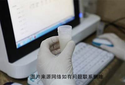 母乳检测仪器独立多通道技术正规医院做母乳检测化验母乳有没有问题